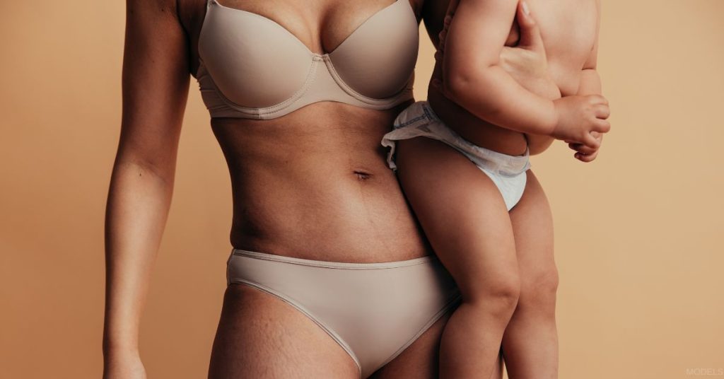 Mother holding her child post mommy makeover (models)