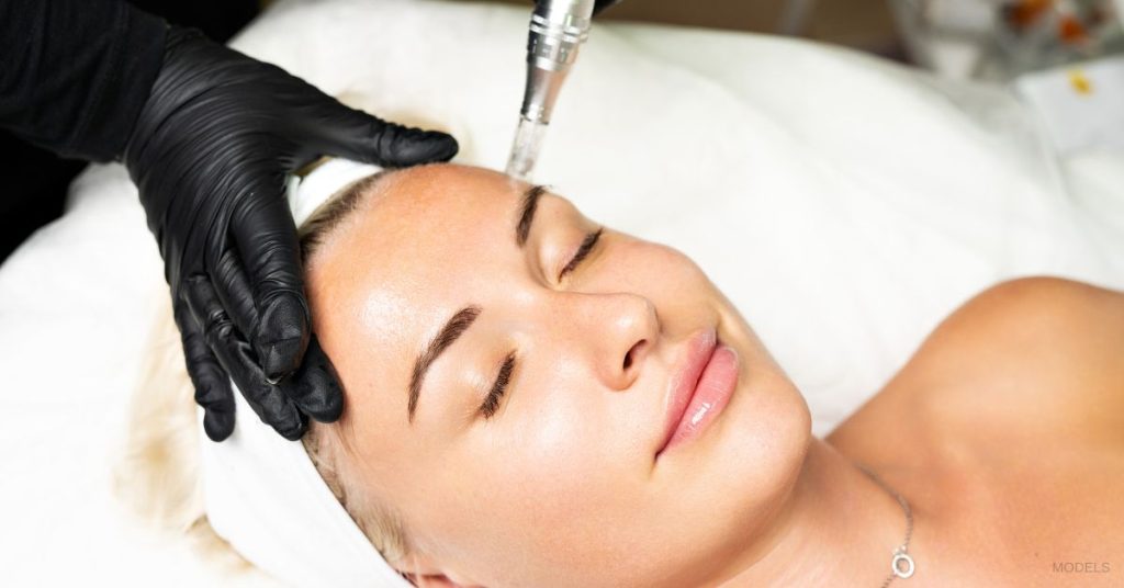 Woman receiving a microneedling treatment. (Models)