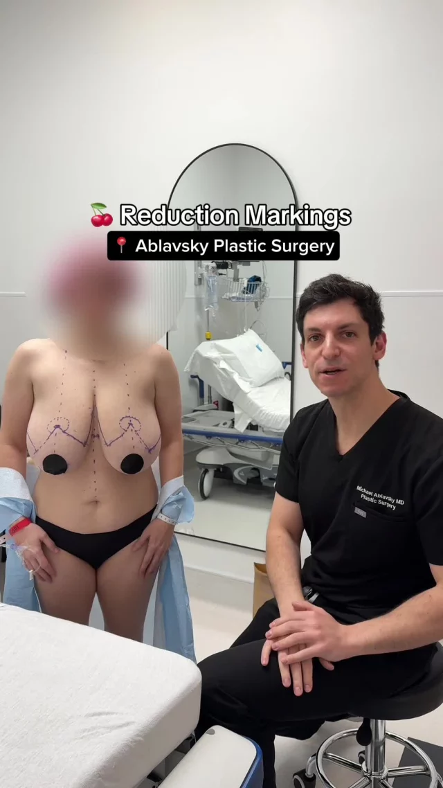 Before the OR, there’s careful planning.
Pre-op markings help ensure a 🍒 reduction that looks and feels right.
ㅤ
📍 19296 Stone Oak Pkwy Ste 102, San Antonio, TX 78258
📞 (210) 942-6672
ㅤ
#Breastreduction #SanAntonio #breastaugmentation