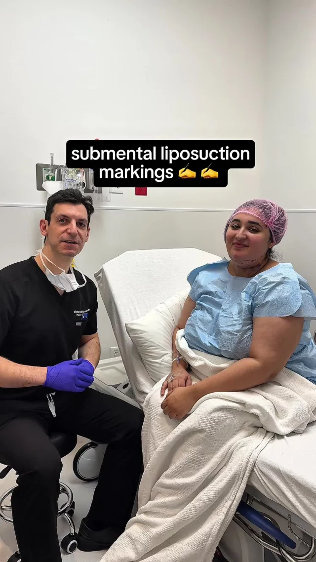 Would you do this?
ㅤ
Here’s the quick breakdown:
• Targets stubborn fat under the chin
• Creates a sharper jawline + smoother profile
• Done under local anesthesia (you’re comfy the whole time)
• Small incision → minimal scarring
• Swelling peaks days 2–3, then improves
• Most patients return to work in a few days
• Final results continue to refine over 3–6 months
• Works best if skin quality is good (or pair with RF tightening)
ㅤ
Drop your questions or call to book a consult!
📍19296 Stone Oak Pkwy Ste 102, San Antonio, Texas 78258
📞 (210) 942-6672
#SubmentalLiposuction #ChinLipo #SanAntonio