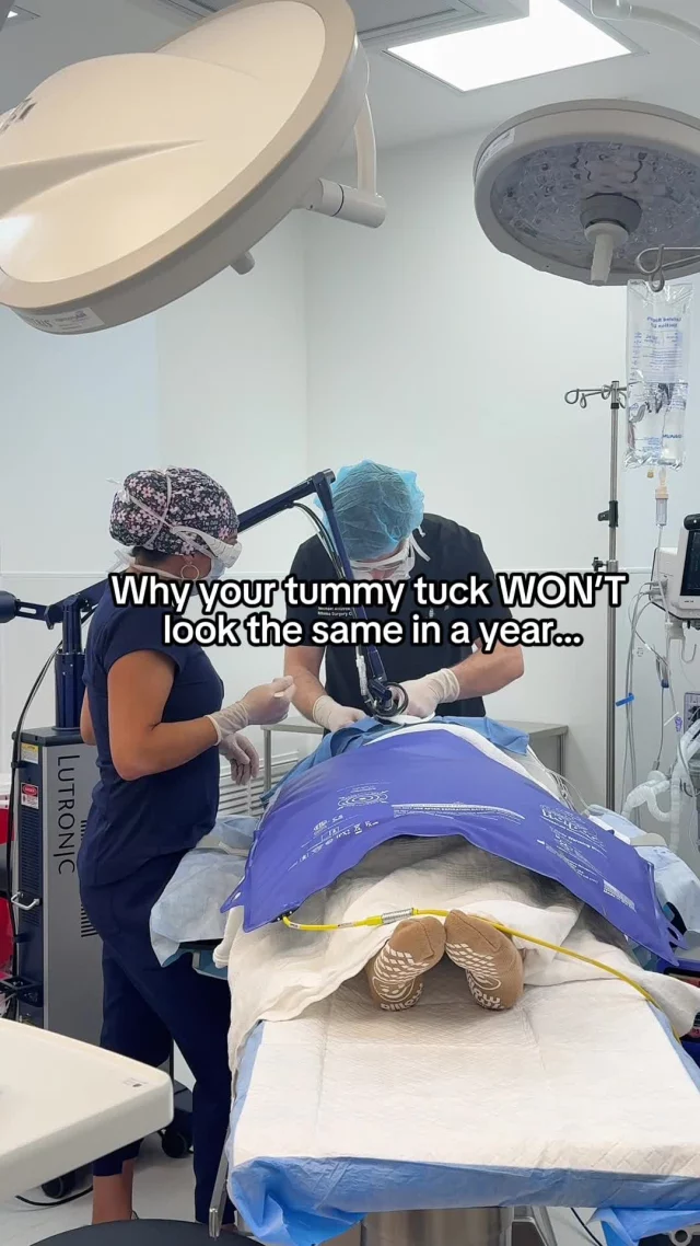 😳
ㅤ
1. Your tummy won’t stay as tight as Day 1
Right after surgery everything is pulled in, compressed, and supported by a garment.
As the tissues relax (totally normal), the abdomen softens.

2. Weak core muscles need retraining
If you had a big diastasis, your muscles were stretched for years.
We repair them surgically, but you still need to rebuild your core.
Patients who skip this tend to see more rounding with time.
ㅤ
3. Visceral fat becomes more noticeable
We can remove external fat… not the fat around your organs.
Once the garment comes off, internal fullness can show. Healthy habits + guidance from your PCP help most here.
ㅤ
4. Upper belly roundness is common
We can’t move your ribcage, so the very top of the abdomen can’t always be tightened as much as the lower portion.
This doesn’t mean something went wrong..it’s anatomy.
ㅤ
5. Lower belly may look flatter over time
The lower abdomen undergoes the most tension + blood-flow changes during surgery.
Sometimes the fat layer thins here more than above, creating a natural difference.
ㅤ
6. Ingrown hairs near the incision can happen
Because the scar sits where hair follicles live. Laser hair reduction = a game changer.
ㅤ
Bottom line
ㅤ
Tummy tucks age beautifully as long as you understand what to expect.
Knowing what’s normal is the difference between loving your result… or thinking something’s wrong when it’s just healing.
Save this for your consult!
ㅤ
📍 19296 Stone Oak Pkwy Ste 102 San Antonio, Texas 78258
☎️ (210) 942-6672
ㅤ
#TummyTucksSanAntonio #MommyMakeoverSanAntonio #PlasticSurgerySanAntonio