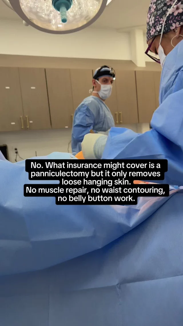 Drop your questions below. 👇🏼
ㅤ
Most patients are surprised to learn that insurance doesn’t cover tummy tucks because it’s considered fully cosmetic — even when there’s loose skin, muscle separation, or discomfort.
ㅤ
What insurance may cover instead is a panniculectomy, but that procedure is very different: it only removes hanging skin and doesn’t repair the muscles, contour the waist, or recreate the belly button.
That’s why the results aren’t comparable to a true tummy tuck.
ㅤ
📍 19296 Stone Oak Pkwy Ste 102, San Antonio, Texas 78258
☎️(210) 942-6672
ㅤ
#MommyMakeoverSanAntonio #tummytuck #sanantonioplasticsurgeon