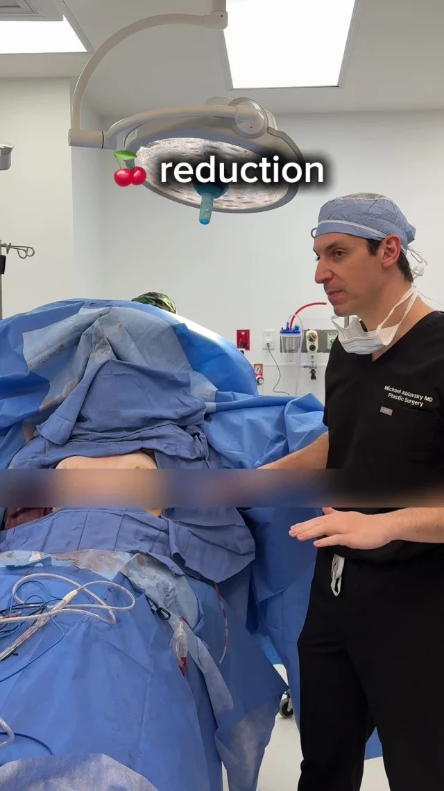 🍒 Reduction Results
ㅤ

#BreastReduction #BreastAugmentation #Mommymakeover
ㅤ