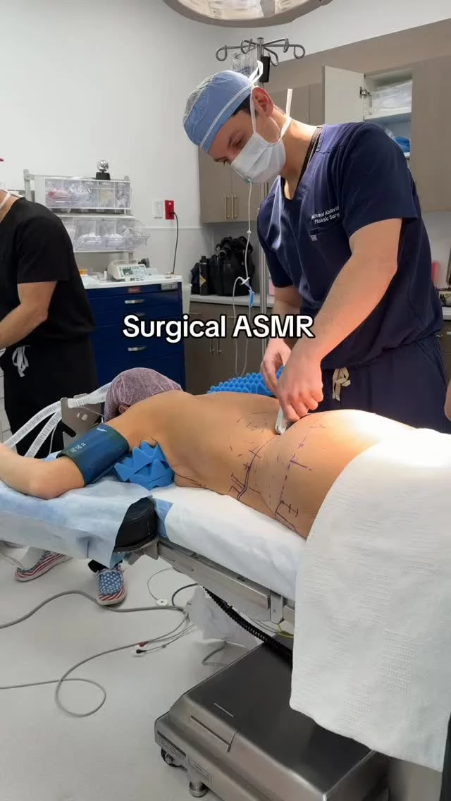 Staples help us close incisions evenly, securely, and with less tension on the skin — which supports smoother healing and better long-term results.
ㅤ
#PlasticSurgerySanAntonio #PlasticSurgeonSanAntonio #SurgerySanAntonio