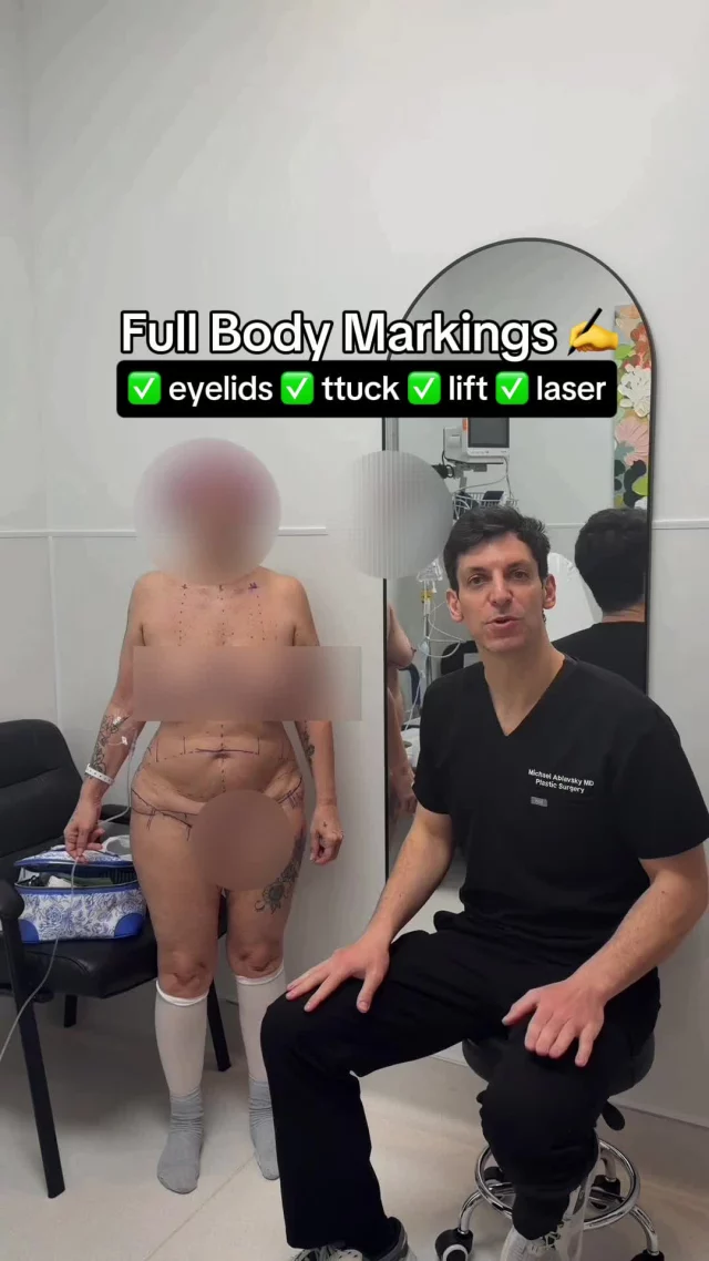 Markings for a full-body surgery today!
ㅤ
#PlasticSurgeon #TummyTuck #MommymakeoverSanAntonio